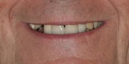 Case 1 Before
