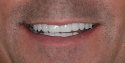 Case 2 After